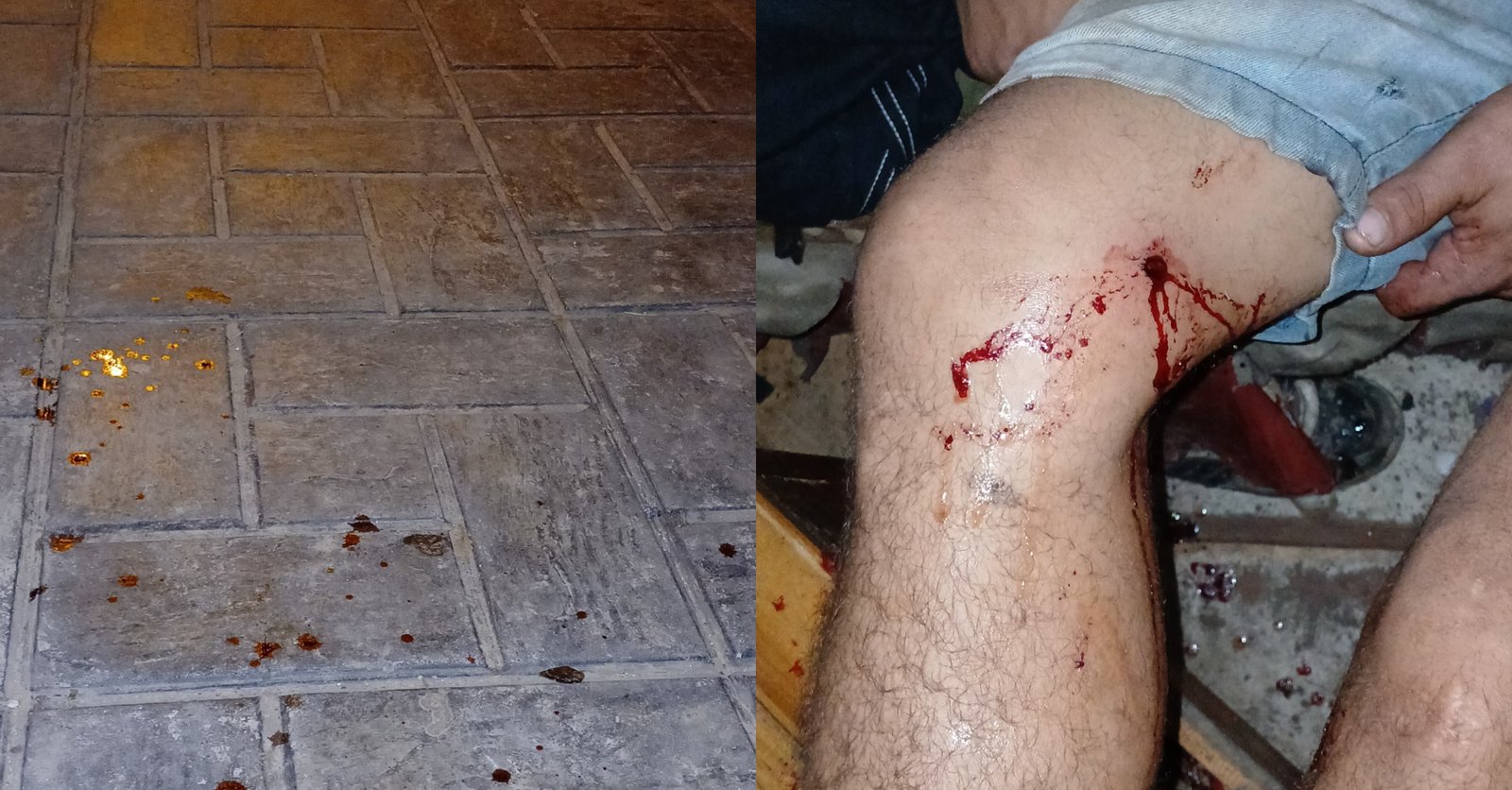 Resistencia: Delincuente disparó en la pierna a otro ladrón en una joda – Portal Móvil